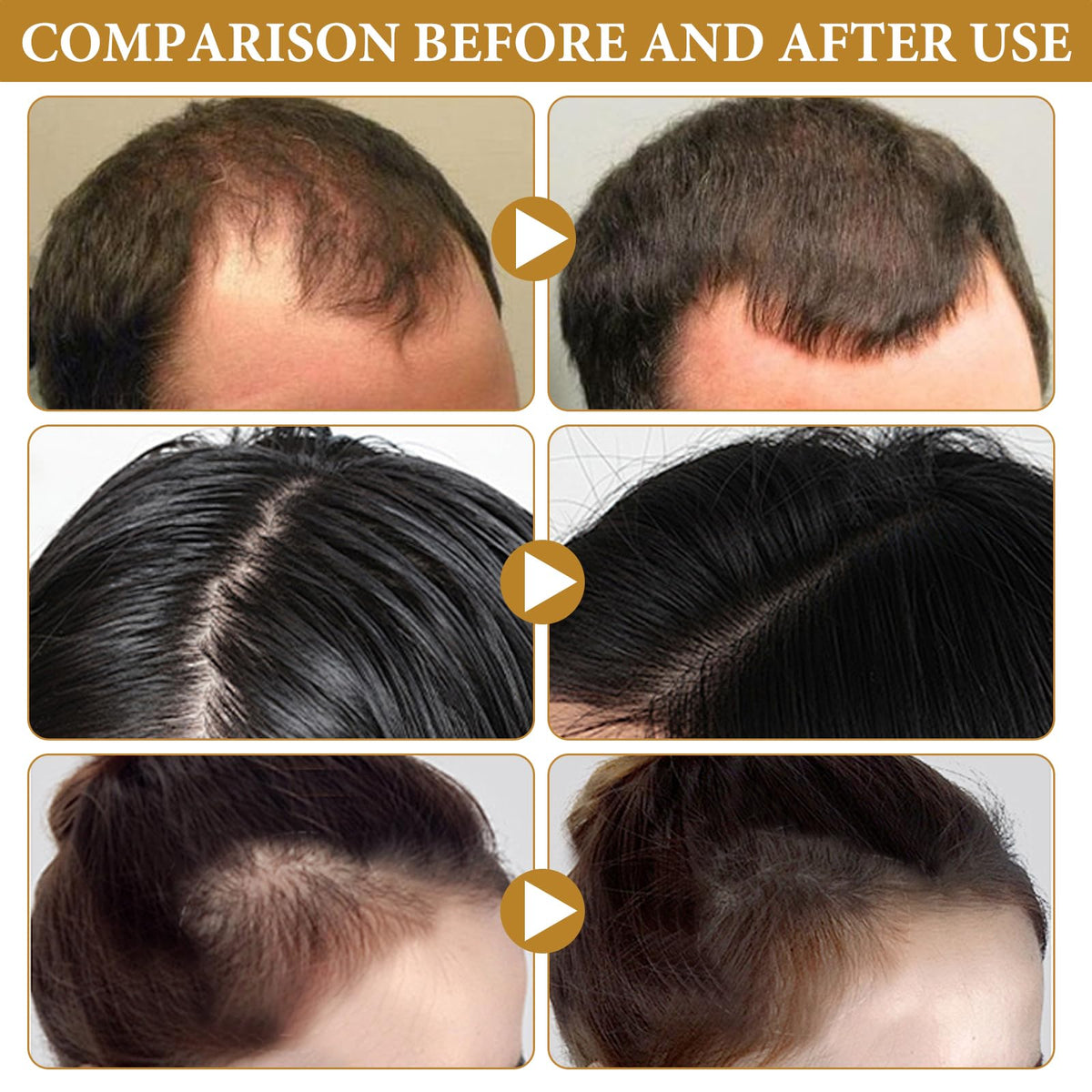 Biotin Hair Spray Repair Hair (imported from germany)